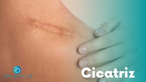 Cicatriz da cesárea pode causar sofrimento às mulheres